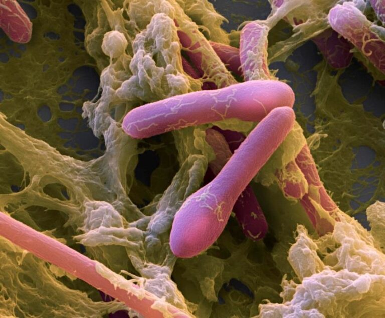 Nguyen nhan gay ra ngo doc thuc pham - Clostridium botulinum